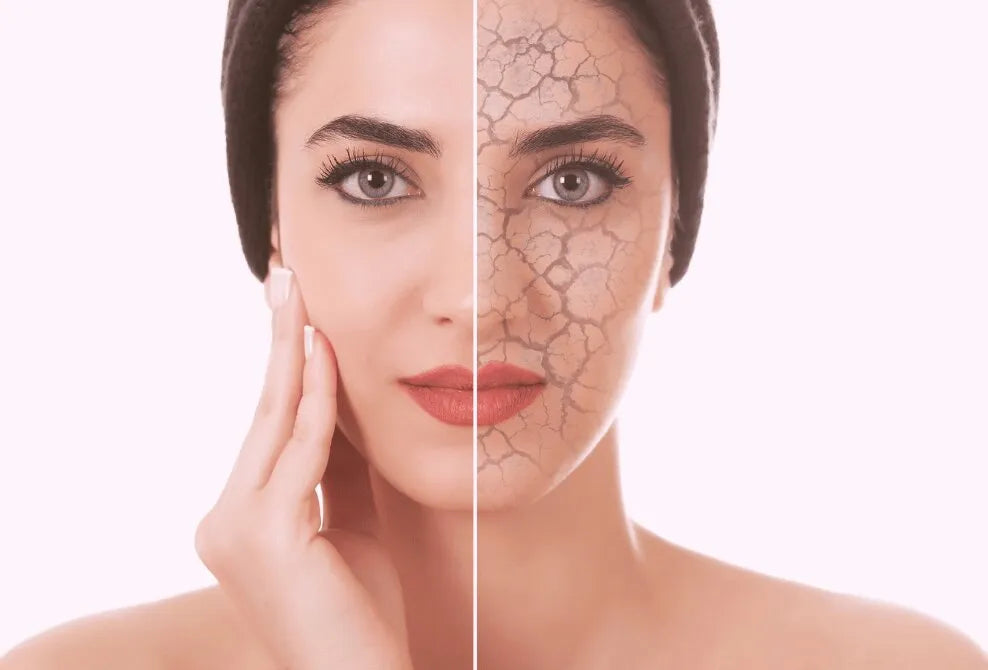 Dry, Dehydrated, what's the difference?