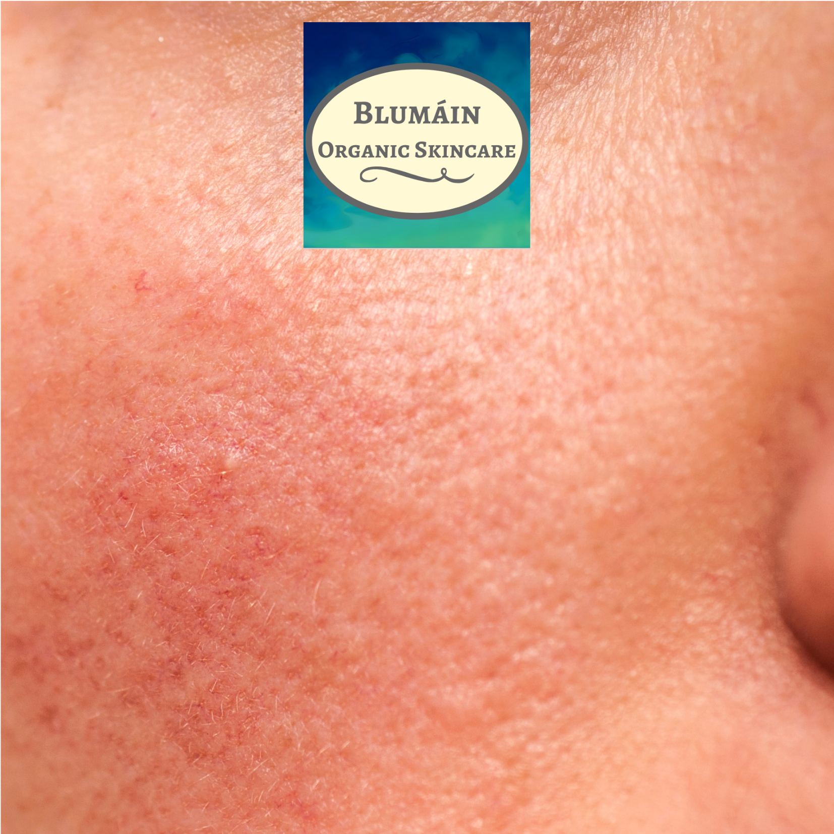 What Is an Impaired Skin Barrier & How to Repair It?